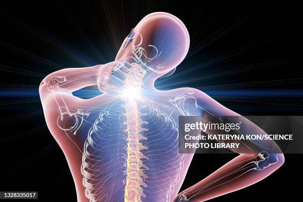 illustrazioni stock, clip art, cartoni animati e icone di tendenza di human neck pain, illustration - scheletro