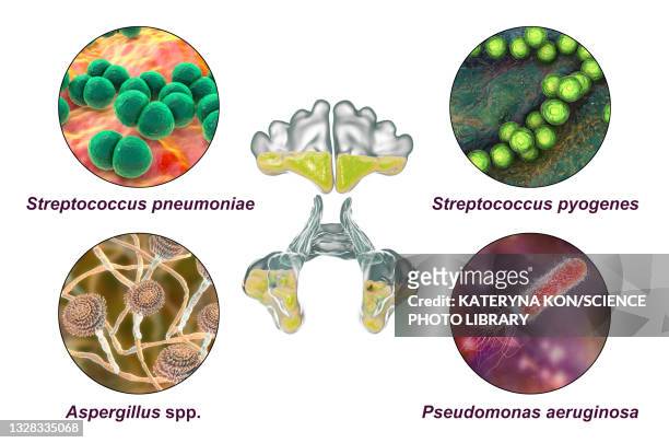 sinusitis, illustration - mucus stock illustrations