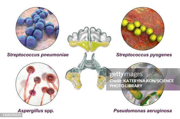 sinusitis, illustration - aspergillus fumigatus stock illustrations