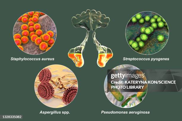 sinusitis, illustration - aspergillus fumigatus stock illustrations