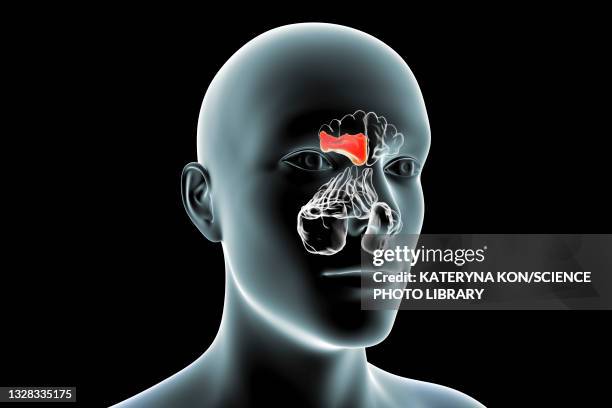 sinusitis, illustration - mucus stock illustrations