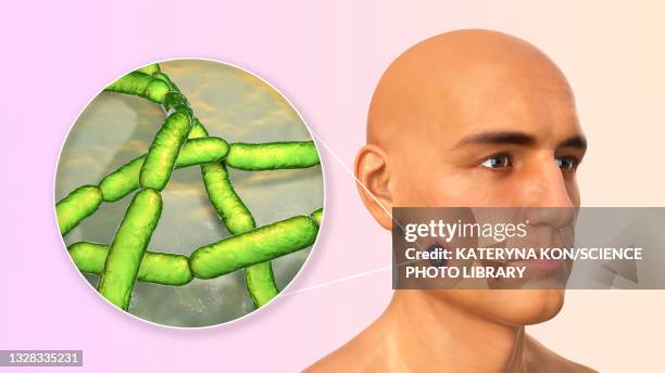 cutaneous anthrax, illustration - man surrounded stock illustrations