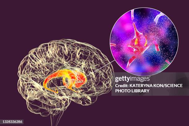 destruction of neurons of the caudate nucleus, illustration - neuropathy stock illustrations