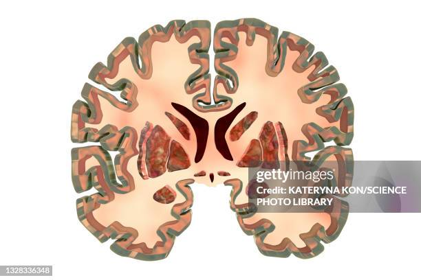 bildbanksillustrationer, clip art samt tecknat material och ikoner med coronal sections of a healthy brain, illustration - basal ganglia