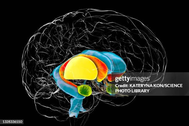 stockillustraties, clipart, cartoons en iconen met dorsal striatum in huntington's disease, illustration - coronaal doorsnede