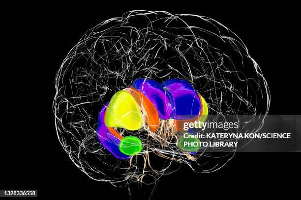 stockillustraties, clipart, cartoons en iconen met dorsal striatum in huntington's disease, illustration - coronaal doorsnede