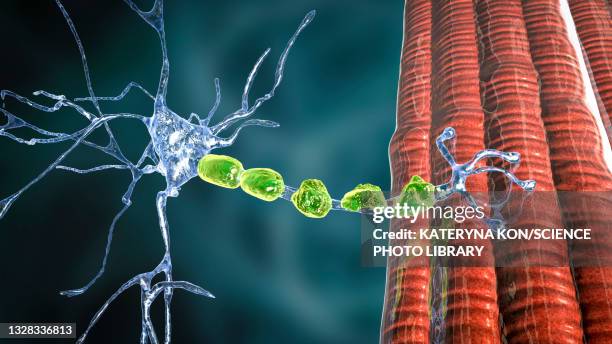 demyelination, illustration - multiple sclerosis stock illustrations