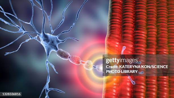 demyelination, illustration - sclerosis stock illustrations