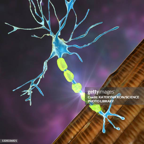 demyelination, illustration - medulla 幅插畫檔、美工圖案、卡通及圖標