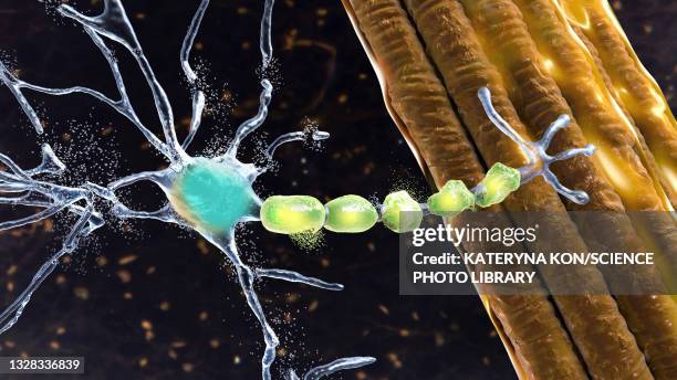 illustrations, cliparts, dessins animés et icônes de degradation of motor neurons, illustration - sclérose latérale amyotrophique