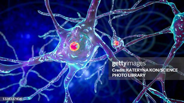 neuronal inclusions in huntington's disease, illustration - corpus striatum stock illustrations