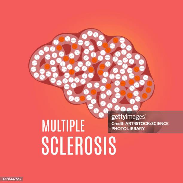 multiple sclerosis, conceptual illustration - sclerosis stock illustrations