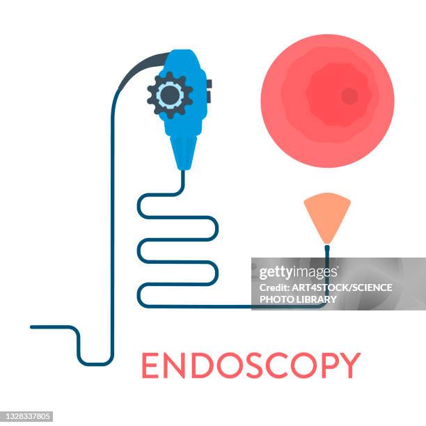endoscopy, conceptual illustration - biopsy stock illustrations
