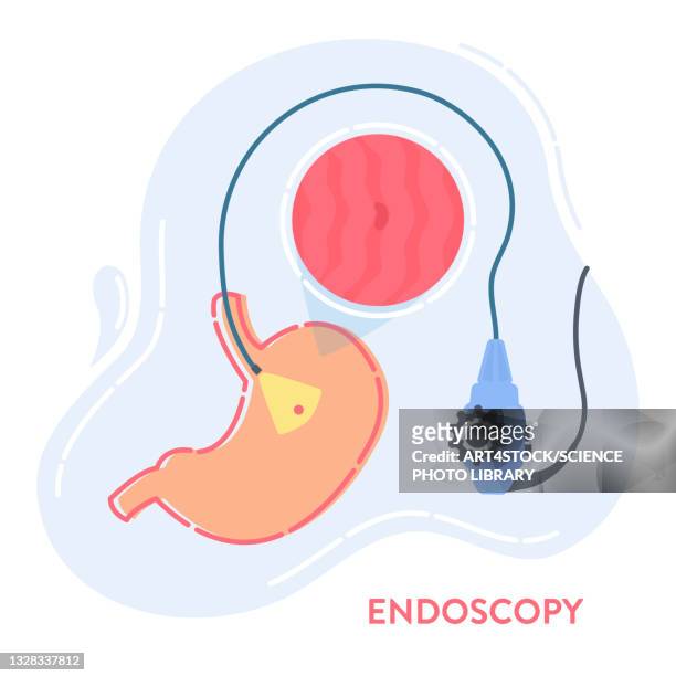 endoscopy, conceptual illustration - abdomen diagram stock illustrations