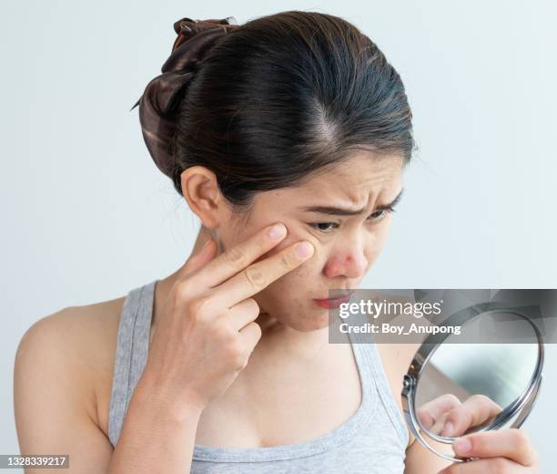 young asian woman worry about her face when she saw the problem of acne occur on her nose. - blackheads stock pictures, royalty-free photos & images