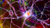 Destruction of neurons of Dorsal striatum, conceptual 3D illustration