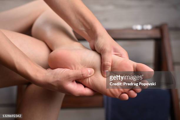 woman in pain massaging her feet - hallux valgus foto e immagini stock