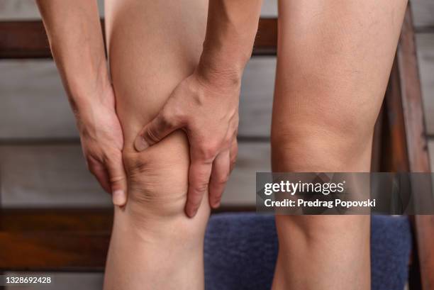woman in pain holding her knee - swollen stock pictures, royalty-free photos & images