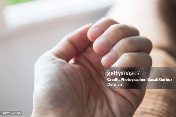 hangnail on little finger - nagelhaut stock-fotos und bilder