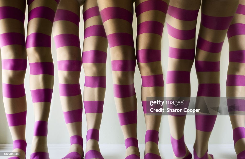 Striped legs