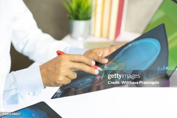 radiology doctor examining at chest x ray film of patient at hospital - röntgenaufnahme stock-fotos und bilder