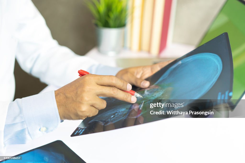Radiology doctor examining at chest x ray film of patient at hospital