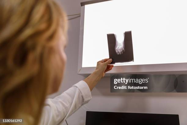 radiologist putting a scan on x-ray lightbox to review it - doctor looking over shoulder stock pictures, royalty-free photos & images