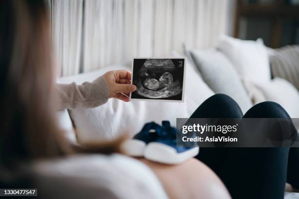 young asian pregnant woman lying on sofa at home, looking at the ultrasound scan photo of her baby, with a pair of baby shoes on her belly. mother-to-be. expecting a new life concept - chinese baby shoe stock pictures, royalty-free photos & images