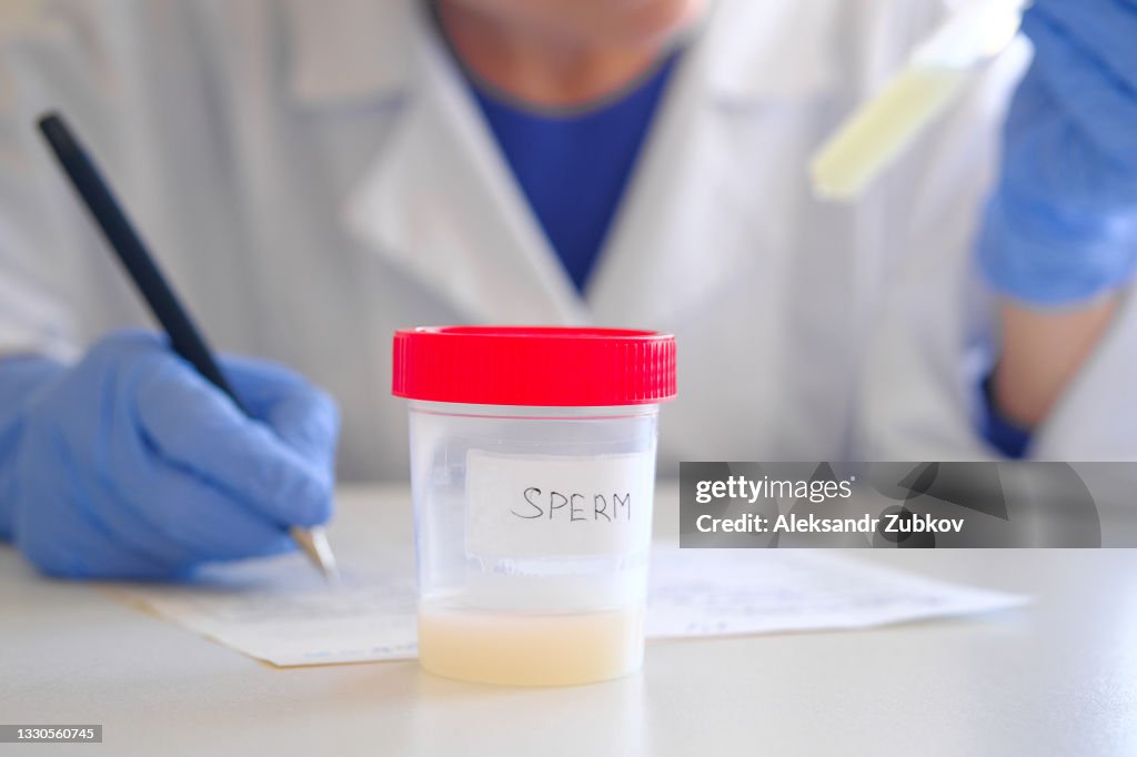A container with a sperm analysis. Nearby, a doctor's hand in medical gloves fills out documents and forms. Donor sperm for artificial insemination, infertility treatment, child planning. Passing an analysis for the detection of pathology. Men's health.