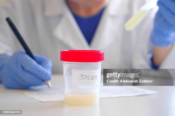 a container with a sperm analysis. nearby, a doctor's hand in medical gloves fills out documents and forms. donor sperm for artificial insemination, infertility treatment, child planning. passing an analysis for the detection of pathology. men's health. - sperm stock pictures, royalty-free photos & images