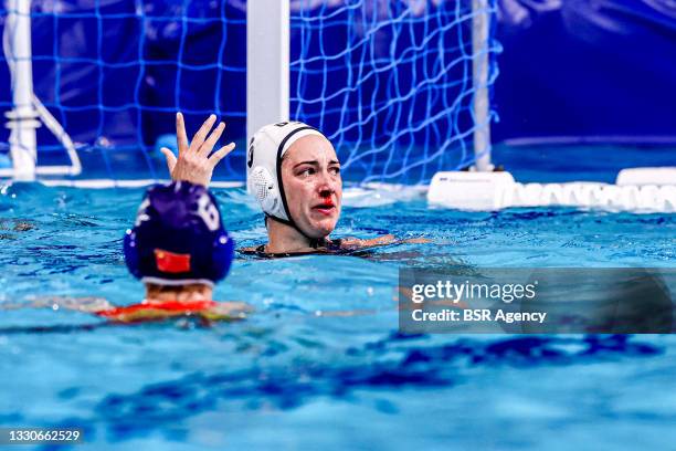 Margaret Steffens of United States injured, bleeding nose during the Tokyo 2020 Olympic Waterpolo Tournament Women match between Team United States...