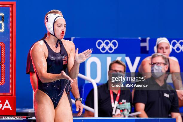 Margaret Steffens of United States injured, bleeding nose during the Tokyo 2020 Olympic Waterpolo Tournament Women match between Team United States...