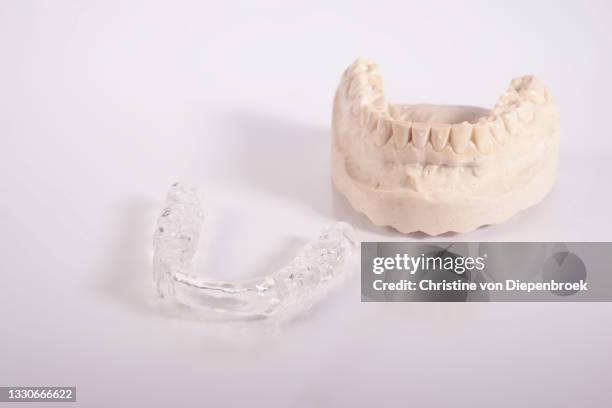 bruxism splint and orthodontic therapy - bruxism stock pictures, royalty-free photos & images