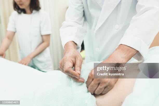 body acupuncture as alternative medicine - acupuncture elderly stock pictures, royalty-free photos & images