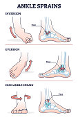 Ankle sprains situations with inversion and eversion injury outline diagram