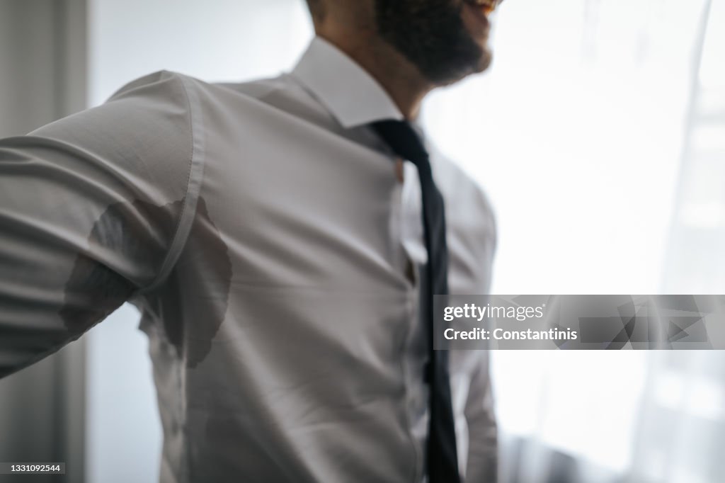 Man with hyperhidrosis sweating under armpit in shirt