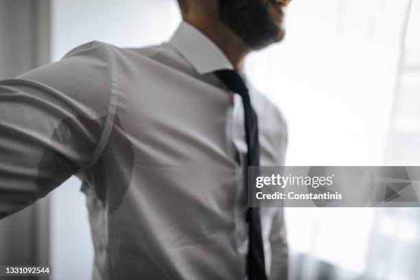 man with hyperhidrosis sweating under armpit in shirt - armpit imagens e fotografias de stock