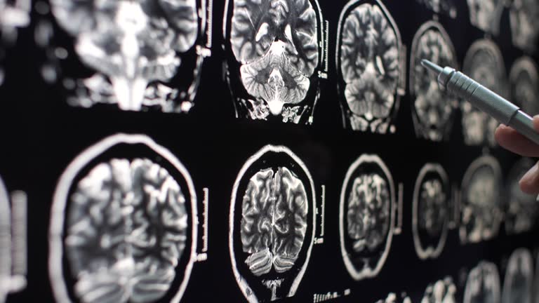 Brain Scan Learning Brain Scans Learning Videos and HD Footage - Getty Images