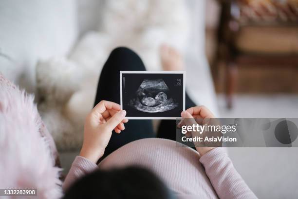 young asian pregnant woman lying on sofa at home, looking at the ultrasound scan photo of her baby. mother-to-be. expecting a new life concept - zwangerschap stockfoto's en -beelden