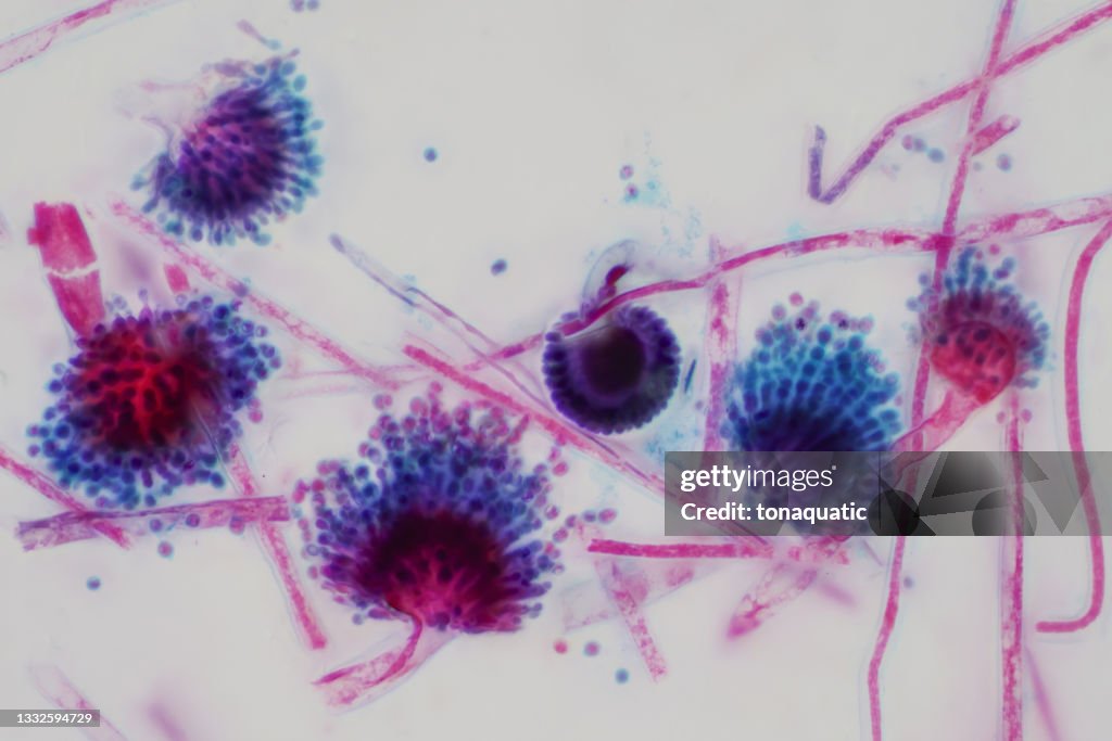 Aspergillus (mold) under the light microscopic view for education.