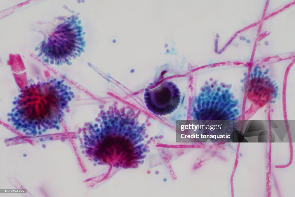Aspergillus (molde) sob a visão microscópica leve para a educação.