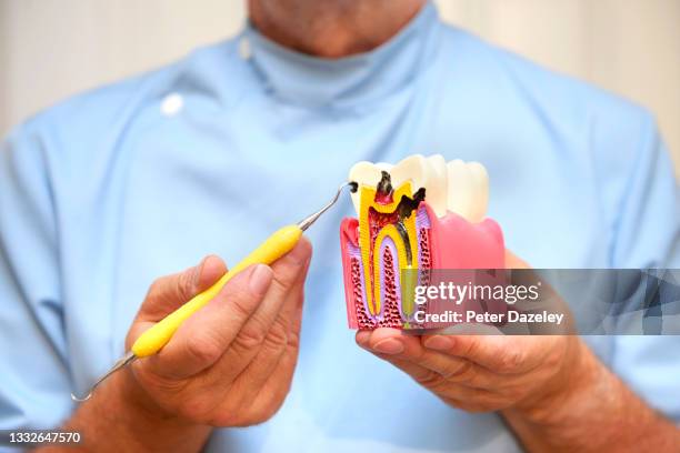 dentist with model tooth showing dental infection - dentist phobia stock-fotos und bilder