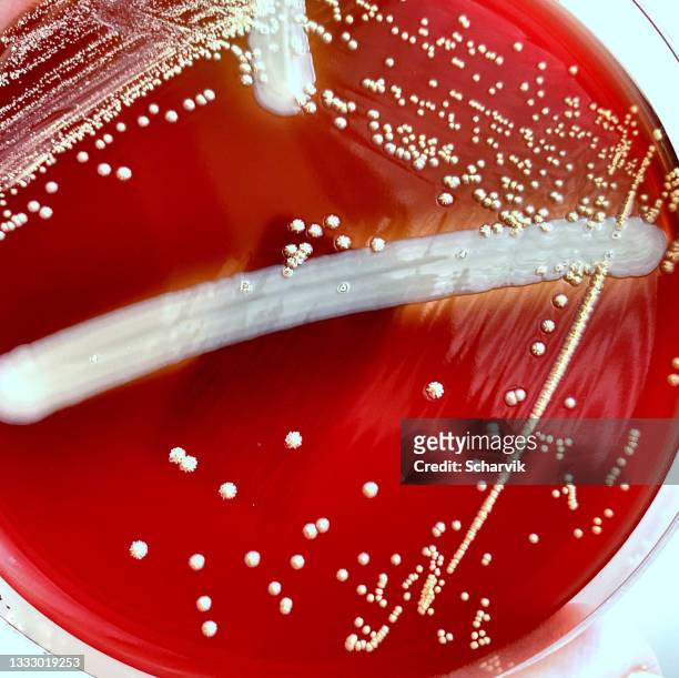 nocardia bacteria - gram stain stockfoto's en -beelden