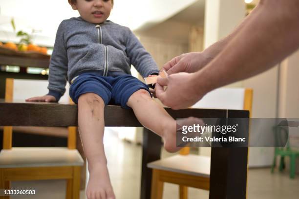 child with injured knee - injured knee stock pictures, royalty-free photos & images