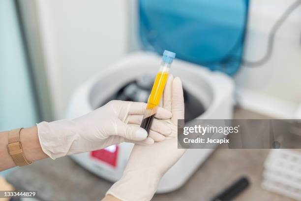 close up od doctor's hands while preparing blood collection tubes for centrifuge machine - plasma rico em plaquetas imagens e fotografias de stock