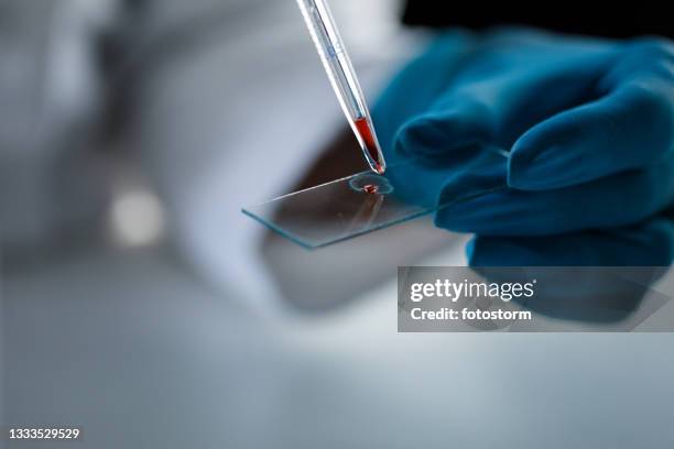drop of blood or red liquid being dripped on a microscope slide - scientific sample stock pictures, royalty-free photos & images