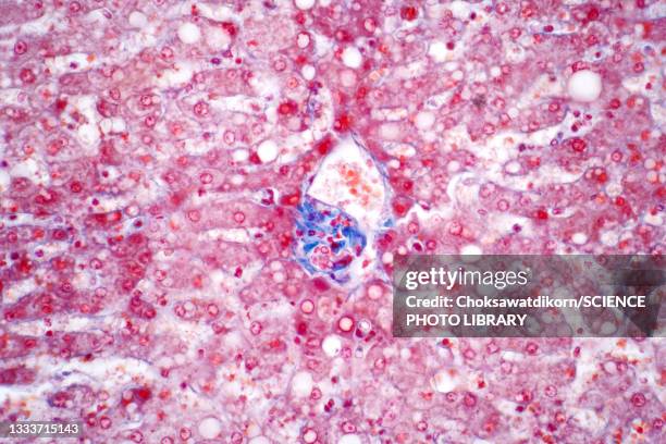 hepatocyte cells, light micrograph - hepatocyte stock pictures, royalty-free photos & images
