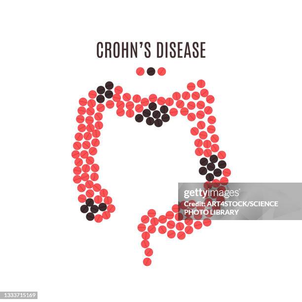 illustrations, cliparts, dessins animés et icônes de intestine disorder, conceptual illustration - digestive system