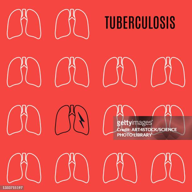 tuberculosis, conceptual illustration - national landmark stock illustrations