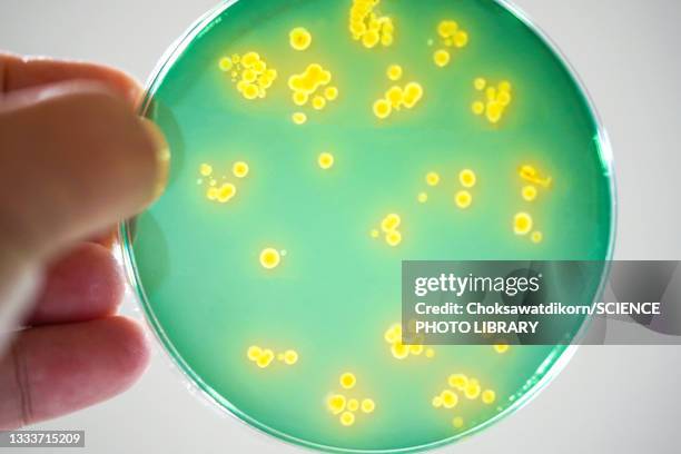 tcbs agar plate, light micrograph - bacteria cultures stock pictures, royalty-free photos & images